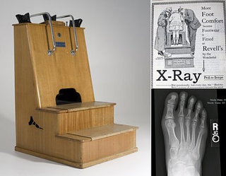 Illustration for article titled When X-rays were given in shoe stores